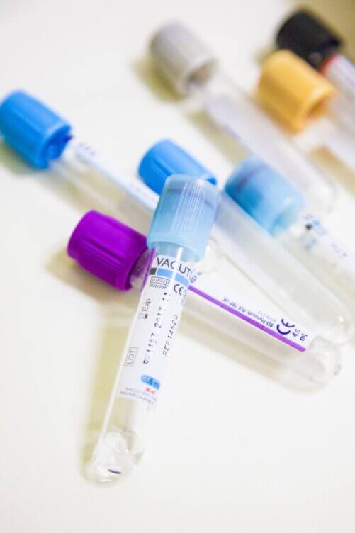 test per le intolleranze alimentari