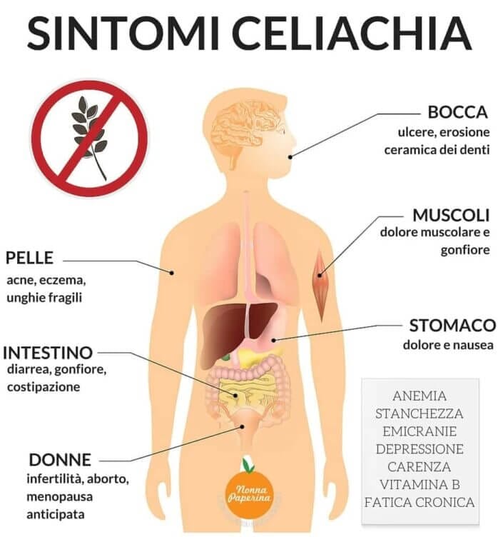 sintomi celiachia nonna paperina sintomi celiachia nonna paperina