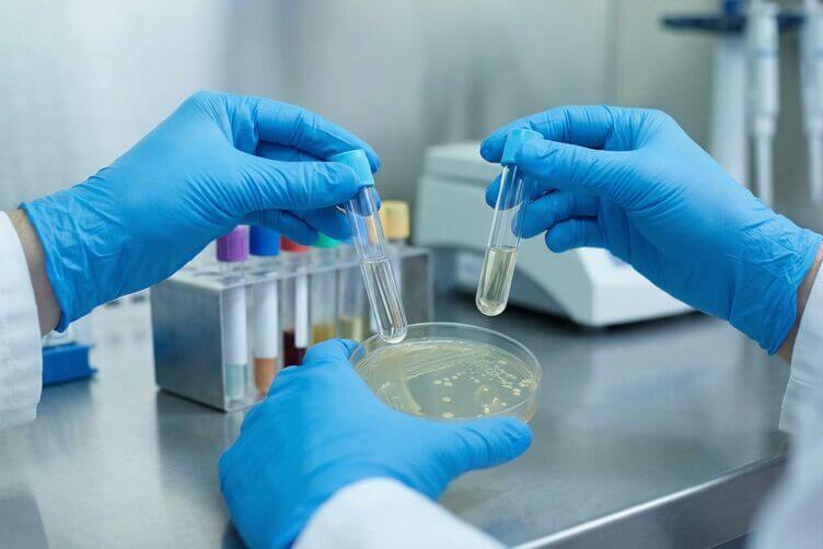 Analisi di laboratorio per approfondire disbiosi intestinale e infiammazione correlata ai sintom Analisi di laboratorio per approfondire disbiosi intestinale e infiammazione correlata ai sintom