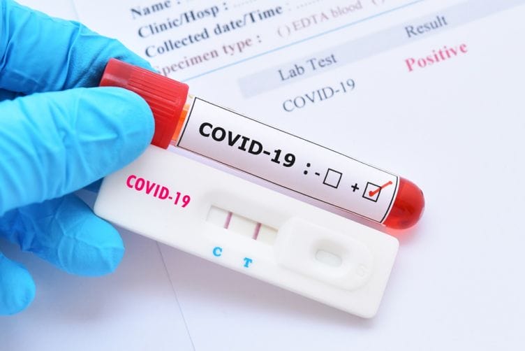 covid19