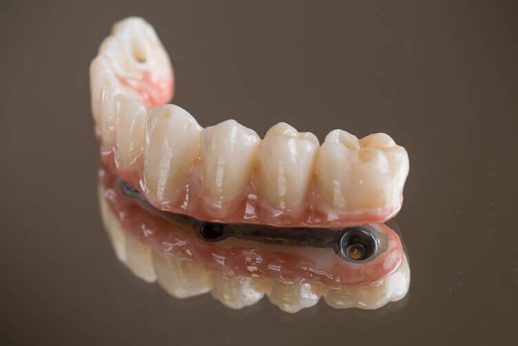 rimozione amalgama dentale rimozione amalgama dentale